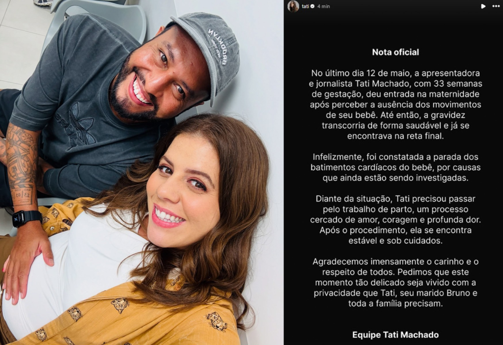 famosas perderam bebês