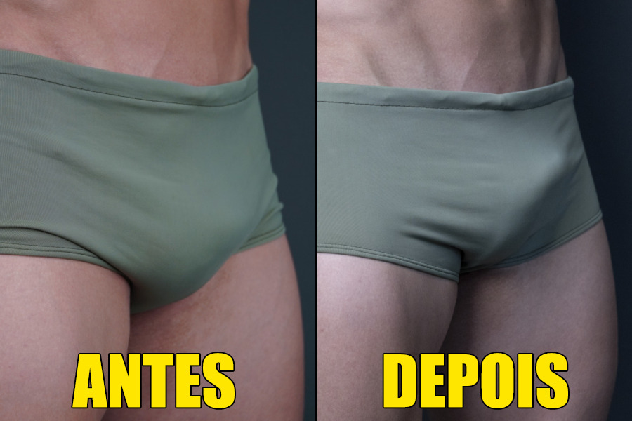 harmonização peniana