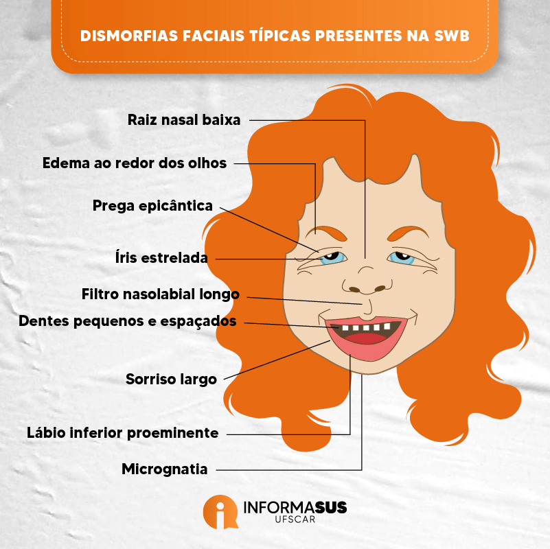 simpática demais